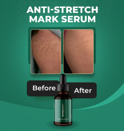 Markaway Stretch Mark Serum – Herbal Formula for Hydration, Toning &amp; Dark Spot Correction (30ml)
